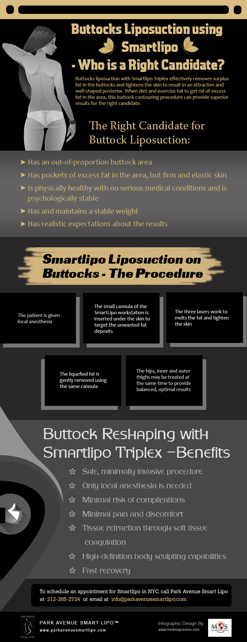 Buttocks Liposuction using Smartlipo