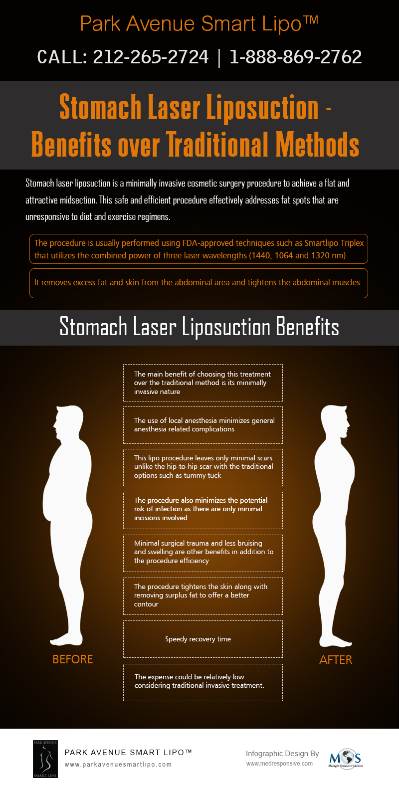 Stomach Laser Liposuction
