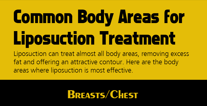 Common Body Areas for Liposuction Treatment [Infographics]