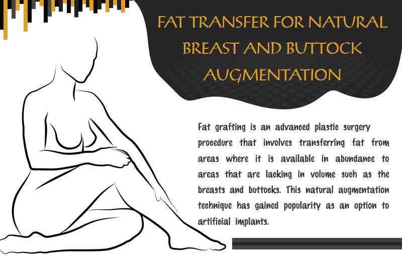 Fat Transfer for Natural Breast and Buttock Augmentation [Infographic]