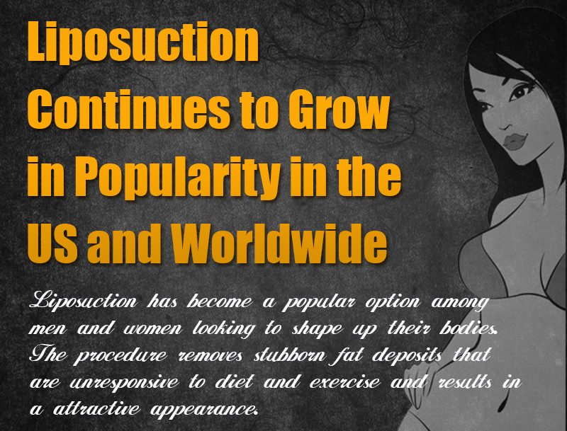 Liposuction a Popular Procedure in the U.S. and Worldwide [Infographic]