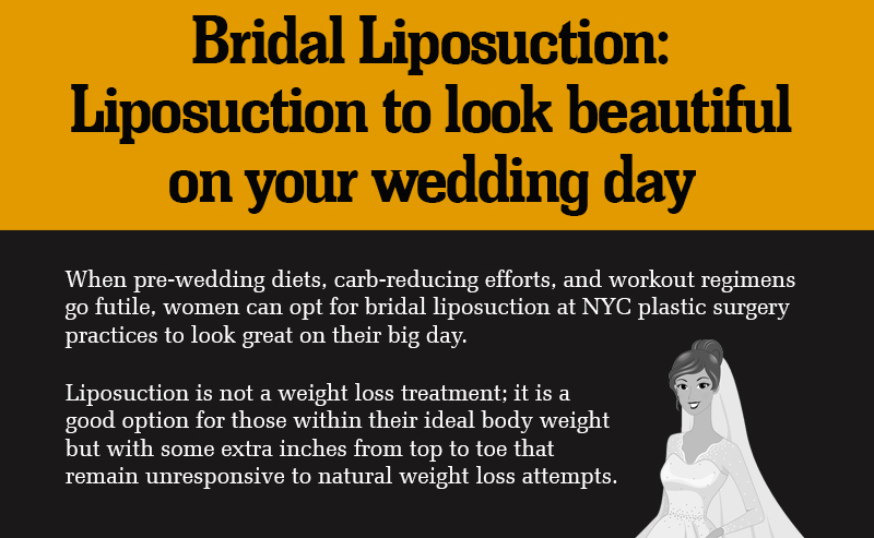 Bridal Liposuction : Liposuction to look beautiful on your wedding day [Infographics]