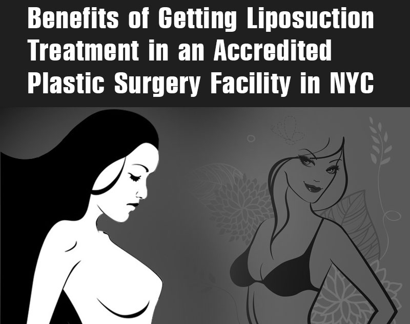 Benefits of Getting Liposuction Treatment in an Accredited Plastic Surgery Facility in NYC [Infographics]