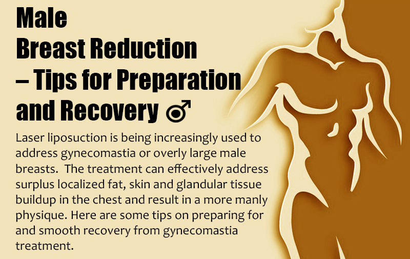 Male Breast Reduction – Tips for Preparation and Recovery [Infographic]