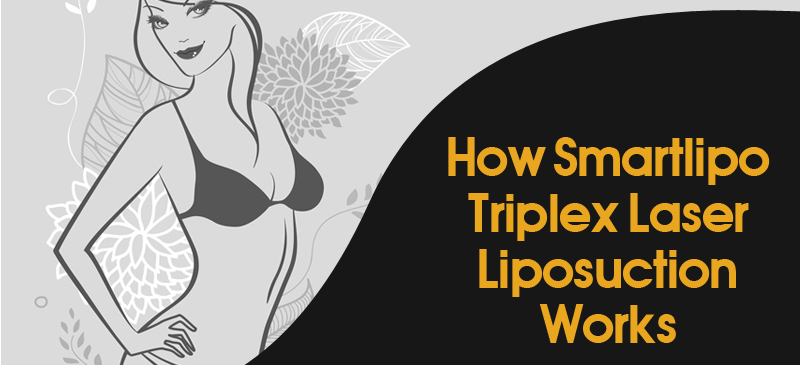 How Smartlipo Triplex Laser Liposuction Works [Infographic]