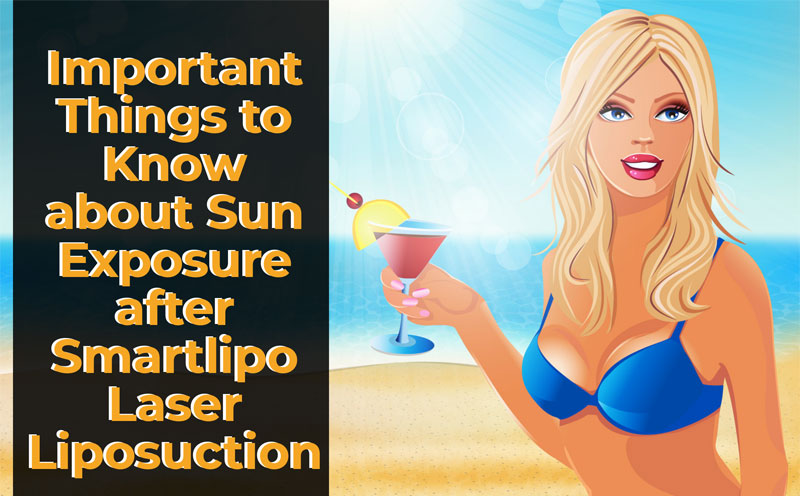 Important Things to Know about Sun Exposure after Smartlipo Laser Liposuction [Infographic]