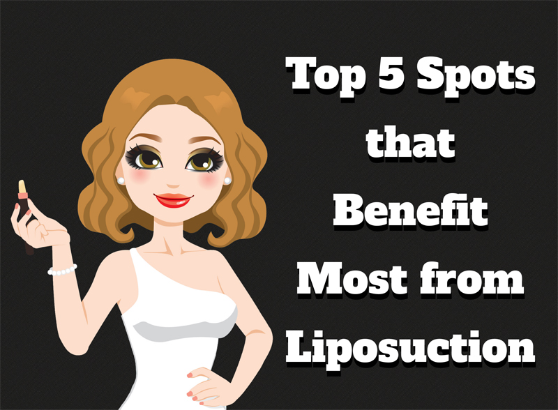 Top 5 Spots that Benefit Most from Liposuction [Infographic]