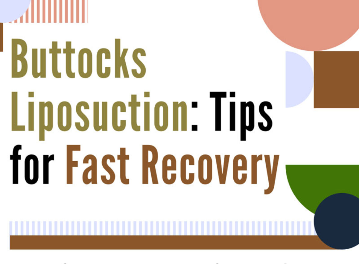 Liposuction Recovery Tips