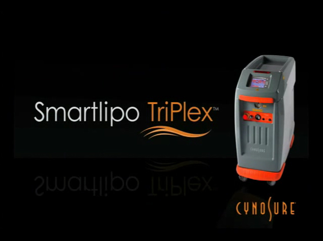 SmartLipo Triplex High Definition Laser Liposuction Video