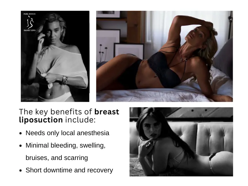 Benefits of Breast Liposuction